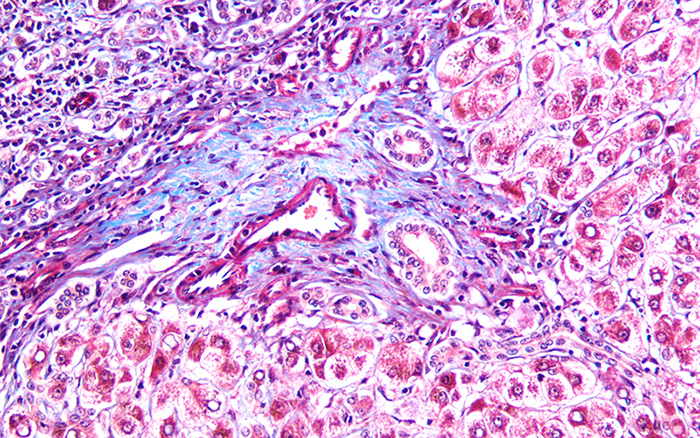 Masson's Trichrome stain