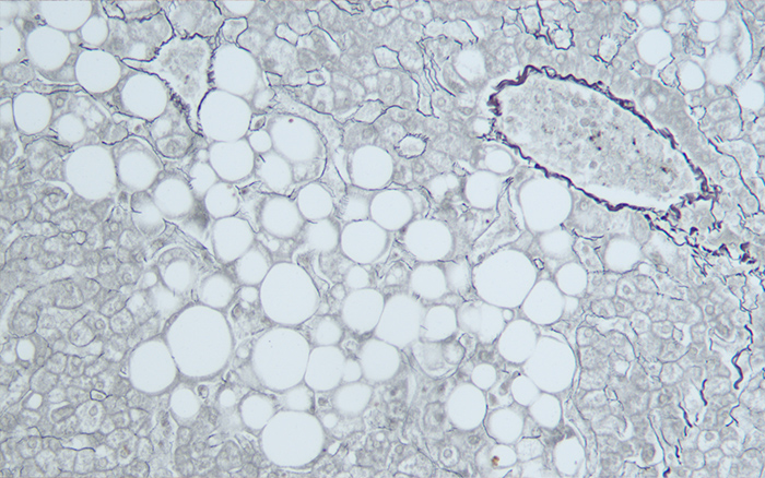 Reticulin Stain