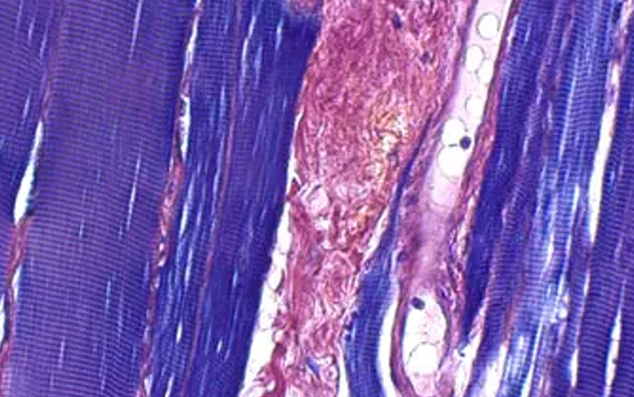 Phosphotungstic acid-hematoxylin(PTAH) stain