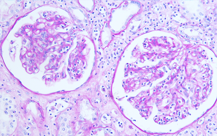 Periodic Acid-Schiff (PAS) stain