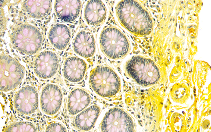 Mucicarmine stain